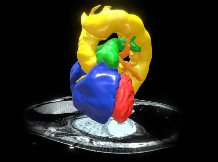 Normal Heart Blood Pool Model