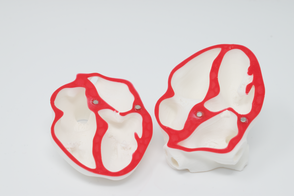 POCUS Heart Slice Models (Set of 3)