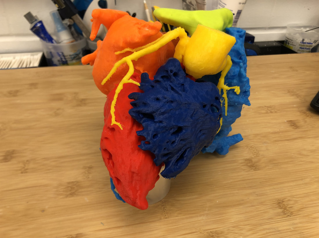 Adult Congenital Heart Disease Models (from Toronto Heart Atlas Collection)